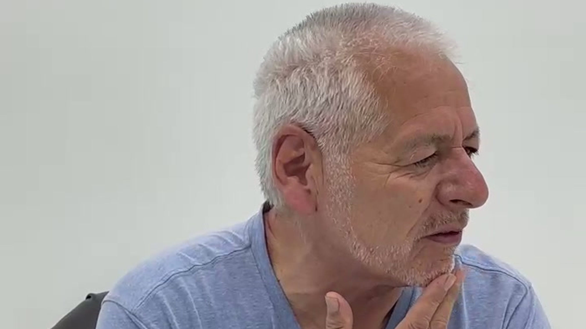 All on 4 patient testimonial